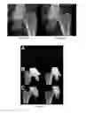Fig. 07 - Morphometry of the human hip joint and prediction of osteoarthritis