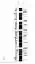 Fig. 03 - Detecting position of word breaks in a textual line image