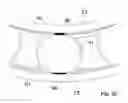 Fig. 05 - Method of moving the rotating means of a wind turbine during transportation or stand still, method of controlling the moving of the rotating means, nacelle, auxiliary device, control and monitoring system and use hereof