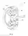 Fig. 03 - Planetary gear