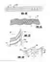 Fig. 13 - Electromagnetic machine with a fiber rotor