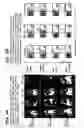 Fig. 08 - MODELS OF ERYTHROPOIESIS
