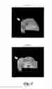 Fig. 05 - Hydroxylated contrast enhancement agents and imaging method