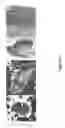 Fig. 17 - SOMATIC CELL-DERIVED PLURIPOTENT CELLS AND METHODS OF USE THEREFOR