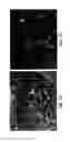 Fig. 04 - Soft tissue and bone augmentation and bulking utilizing muscle-derived progenitor cells, compositions and treatments thereof