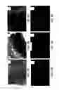 Fig. 06 - Soft tissue and bone augmentation and bulking utilizing muscle-derived progenitor cells, compositions and treatments thereof