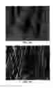 Fig. 09 - Soft tissue and bone augmentation and bulking utilizing muscle-derived progenitor cells, compositions and treatments thereof