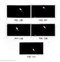 Fig. 16 - Soft tissue and bone augmentation and bulking utilizing muscle-derived progenitor cells, compositions and treatments thereof