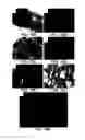 Fig. 19 - Soft tissue and bone augmentation and bulking utilizing muscle-derived progenitor cells, compositions and treatments thereof