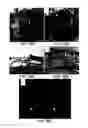 Fig. 20 - Soft tissue and bone augmentation and bulking utilizing muscle-derived progenitor cells, compositions and treatments thereof