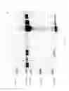 Fig. 16 - Compositions and Methods for Treating Collagen-Mediated Diseases