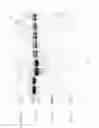 Fig. 25 - Compositions and Methods for Treating Collagen-Mediated Diseases