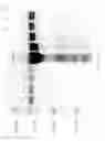 Fig. 28 - Compositions and Methods for Treating Collagen-Mediated Diseases