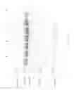 Fig. 35 - Compositions and Methods for Treating Collagen-Mediated Diseases