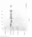 Fig. 40 - Compositions and Methods for Treating Collagen-Mediated Diseases