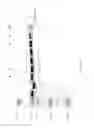 Fig. 43 - Compositions and Methods for Treating Collagen-Mediated Diseases