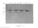Fig. 53 - Compositions and Methods for Treating Collagen-Mediated Diseases