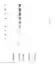 Fig. 60 - Compositions and Methods for Treating Collagen-Mediated Diseases