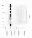 Fig. 70 - Compositions and Methods for Treating Collagen-Mediated Diseases