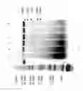 Fig. 72 - Compositions and Methods for Treating Collagen-Mediated Diseases