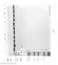 Fig. 80 - Compositions and Methods for Treating Collagen-Mediated Diseases