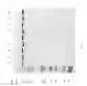 Fig. 82 - Compositions and Methods for Treating Collagen-Mediated Diseases