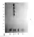 Fig. 84 - Compositions and Methods for Treating Collagen-Mediated Diseases