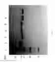 Fig. 86 - Compositions and Methods for Treating Collagen-Mediated Diseases