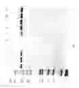 Fig. 89 - Compositions and Methods for Treating Collagen-Mediated Diseases