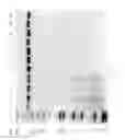 Fig. 90 - Compositions and Methods for Treating Collagen-Mediated Diseases