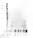 Fig. 91 - Compositions and Methods for Treating Collagen-Mediated Diseases