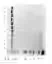 Fig. 92 - Compositions and Methods for Treating Collagen-Mediated Diseases