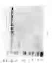 Fig. 93 - Compositions and Methods for Treating Collagen-Mediated Diseases