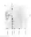 Fig. 06 - Compositions and Methods for Treating Collagen-Mediated Diseases