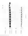 Fig. 11 - Compositions and Methods for Treating Collagen-Mediated Diseases