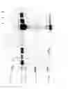 Fig. 16 - Compositions and Methods for Treating Collagen-Mediated Diseases