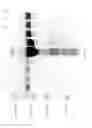 Fig. 28 - Compositions and Methods for Treating Collagen-Mediated Diseases