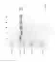Fig. 40 - Compositions and Methods for Treating Collagen-Mediated Diseases