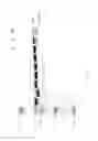 Fig. 43 - Compositions and Methods for Treating Collagen-Mediated Diseases