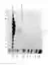 Fig. 46 - Compositions and Methods for Treating Collagen-Mediated Diseases