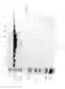 Fig. 48 - Compositions and Methods for Treating Collagen-Mediated Diseases
