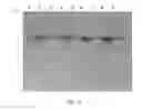 Fig. 53 - Compositions and Methods for Treating Collagen-Mediated Diseases
