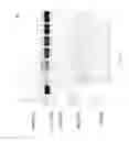 Fig. 70 - Compositions and Methods for Treating Collagen-Mediated Diseases