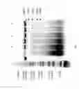Fig. 72 - Compositions and Methods for Treating Collagen-Mediated Diseases