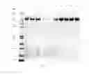Fig. 76 - Compositions and Methods for Treating Collagen-Mediated Diseases