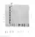 Fig. 79 - Compositions and Methods for Treating Collagen-Mediated Diseases