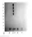 Fig. 84 - Compositions and Methods for Treating Collagen-Mediated Diseases