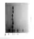 Fig. 85 - Compositions and Methods for Treating Collagen-Mediated Diseases