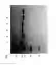 Fig. 86 - Compositions and Methods for Treating Collagen-Mediated Diseases