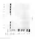 Fig. 89 - Compositions and Methods for Treating Collagen-Mediated Diseases